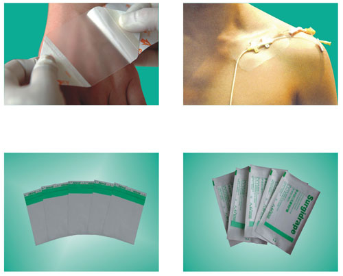 供应一次性医用耗材--一次性使用无菌手术膜留置针专用型