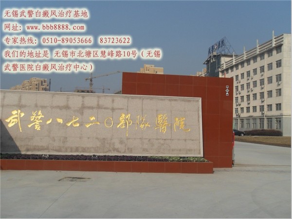 白癜风传染吗嘉兴白癜风医院为您提供详细意见