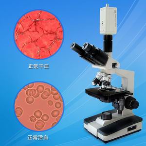 双目一滴血检测仪