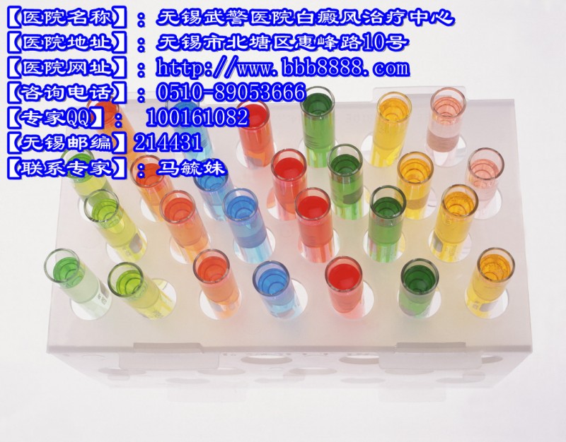 徐州白癜风茶文化在白癜风中的极大作用无锡武@警白癜风治疗中心