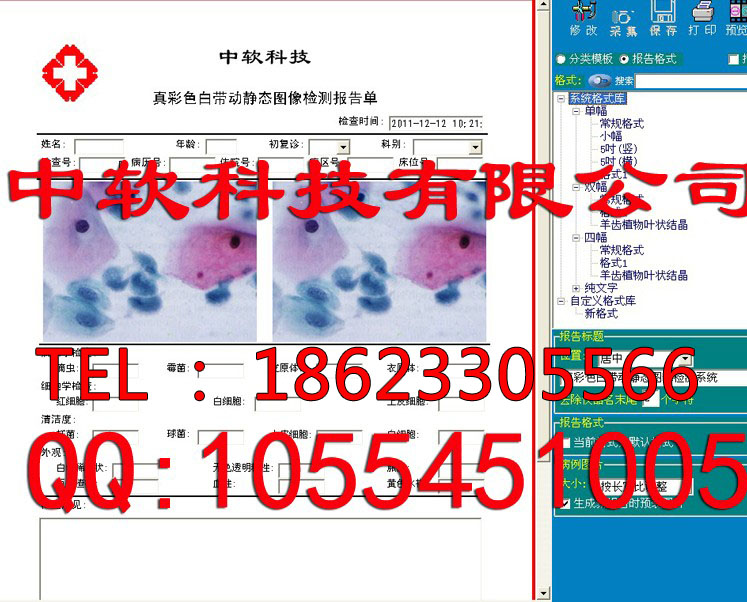 白带分析软件白带检测软件白带常规检测软件