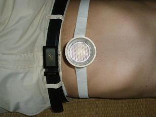 招代理灸疗器艾灸排毒养颜