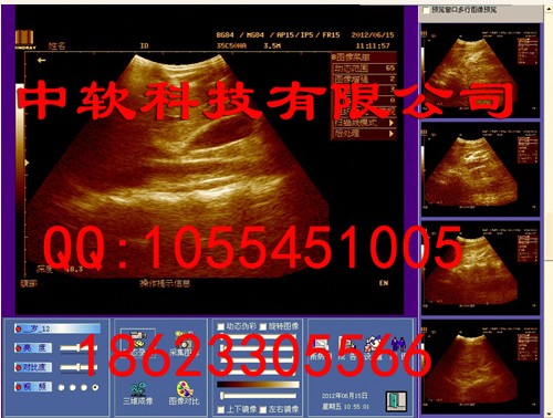 正版超声随心所欲软件，彩超软件，B超工作站软件下载