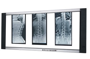 YGD-03型调光型液晶双联X光片观片灯